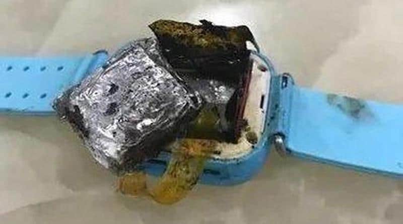 Another report of an exploding smartwatch, causes third-degree burns